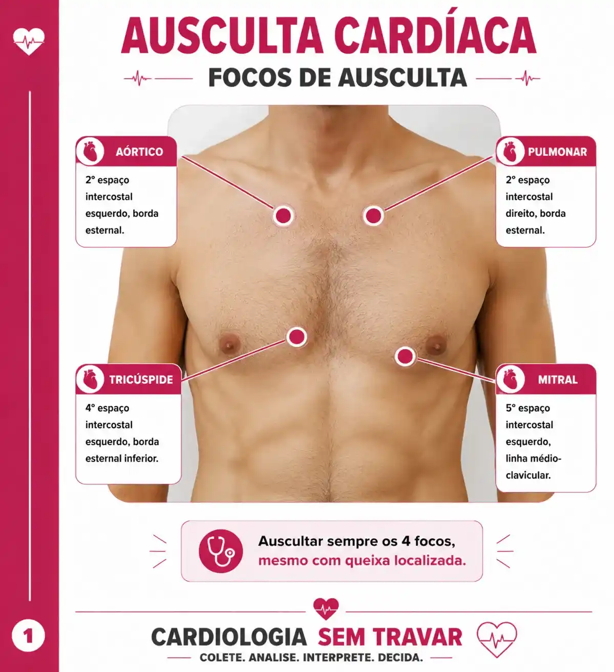 Focos de ausculta